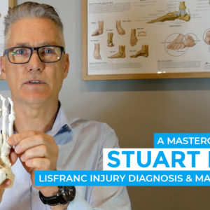 Stuart Imer - Lisfranc Injury Diagnosis